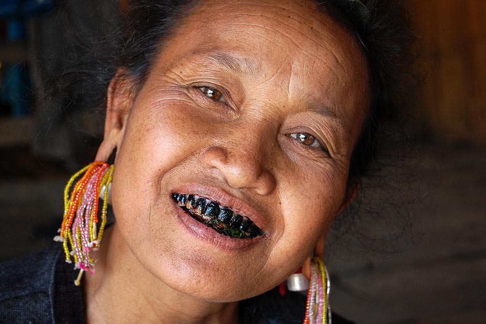 Ann woman with distinctive black teeth. 